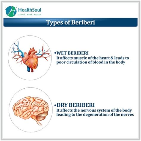 Beriberi: Overview, Symptoms, Causes, Diagnosis and Management - Healthsoul