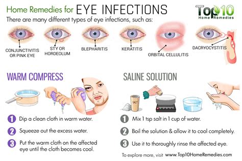 Home Remedies for Eye Infections | Top 10 Home Remedies | Stuffy nose ...