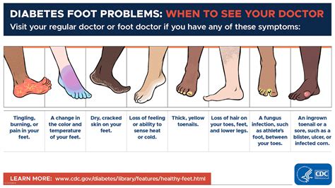 Your Feet and Diabetes | Diabetes | CDC