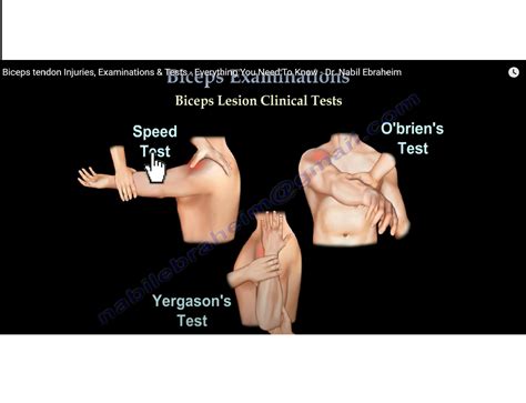 Yergasons Test