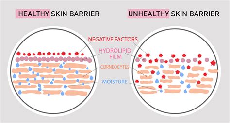 "Is Your Moisture Barrier Compromised?" by Cora Speidel | DERMASPACE