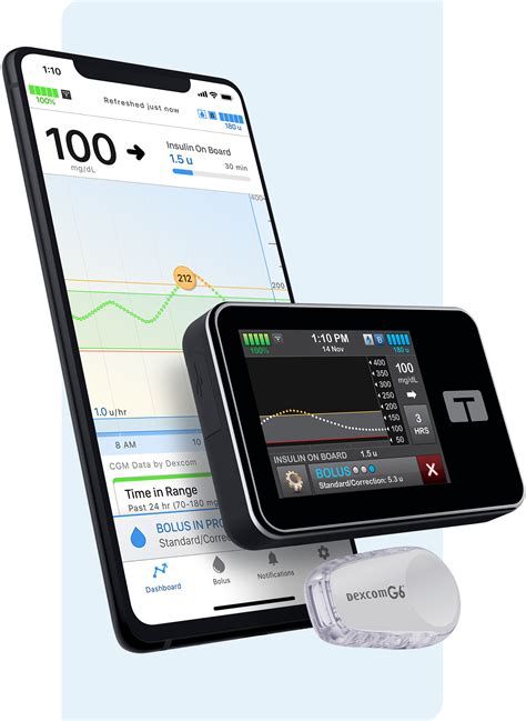 Dexcom & t:slim X2 Insulin Pump | Tandem Diabetes Care (2023)