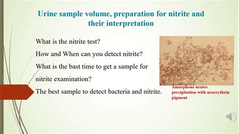 Leukocyte Esterase and Nitrite detection in urine analysis - YouTube