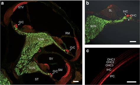 Histology of Gtf2ird1−/− cochlea confirms normal cytoarchitecture. (a ...