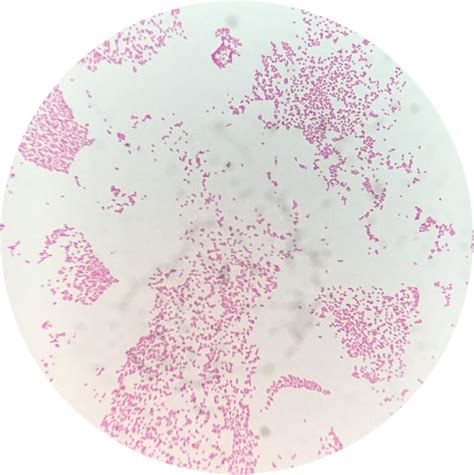 Gram Stain Of A Urine Specimen With Klebsiella Pneumonia