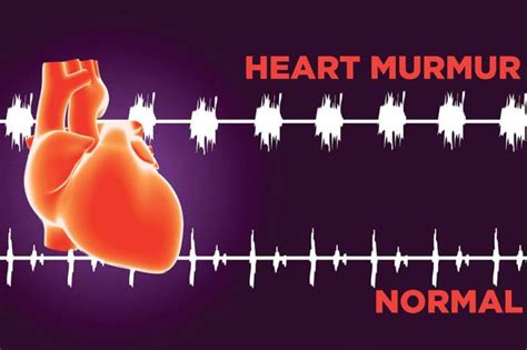 Heart Murmur: Silent Signs You Need to Know | Reader's Digest