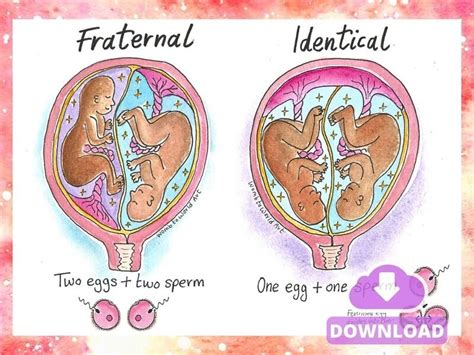 Twins Diagrams A4 Handout | Antenatal Downloads