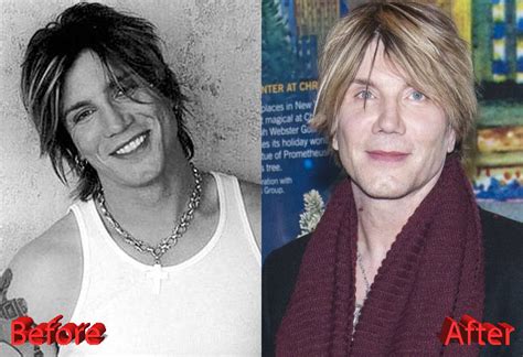 John Rzeznik Plastic Surgery: Was It A Win Or Fail?