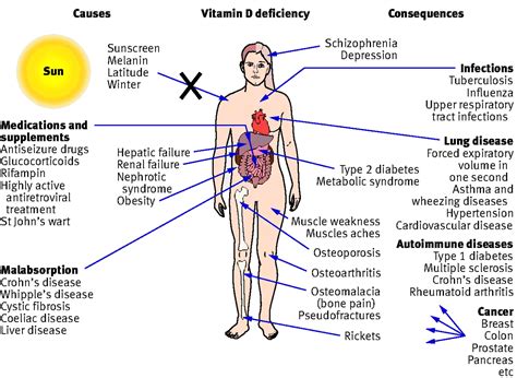 Vitamin D - D3 Benefits & Difficiency In Neck & Back Pain