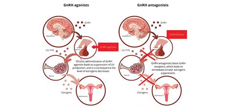 Understanding Gonadotropin Releasing Hormone Analogs: Mechanism, Clinical Uses, and Comparisons