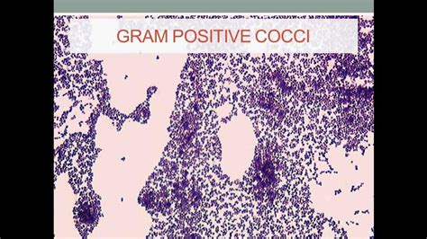 Bacteriology- Staphylococcus (Gram Positive Cocci) - YouTube