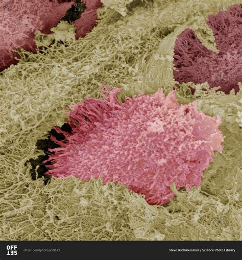 Hyaline cartilage under a Color scanning electron micrograph of a ...