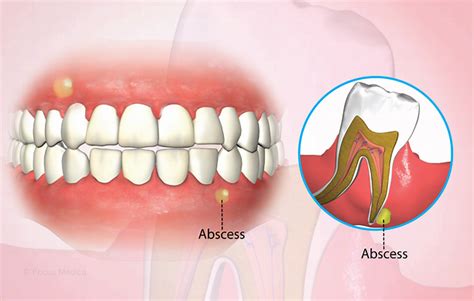 Health Condition : Symptoms, Causes, Treatment and More