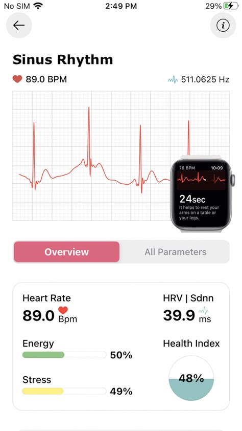 ECG heart analyze - watch for iPhone - Download