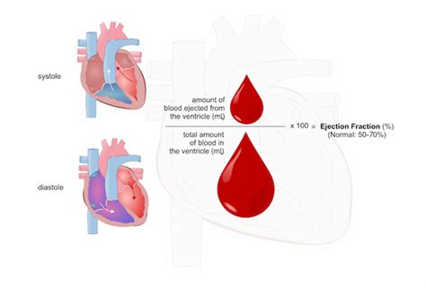 Assessing Left Ventricular Ejection Fraction With, 47% OFF