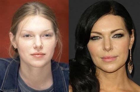 Laura Prepon before and after plastic surgery 2 – Celebrity plastic surgery online