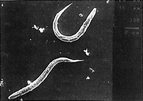 Manifestations, Diagnosis, and Treatment of Strongyloides stercoralis ...