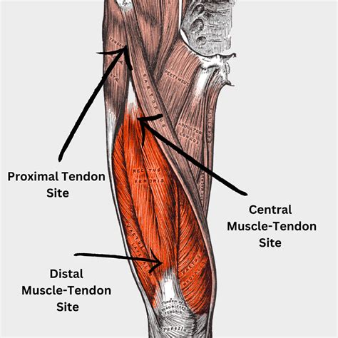 Quadriceps Femoris Tendon