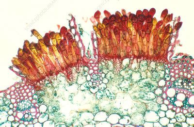 Puccinia graminis - Stock Image - C027/7987 - Science Photo Library