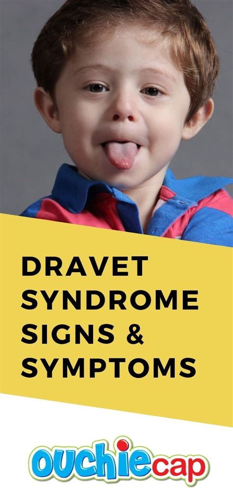 Dravet Syndrome Signs Symptoms & Aid Moms Need To Know #firstaid Dravet Syndrome Signs ...