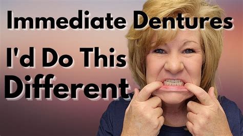 Immediate Dentures After A Full Mouth Extraction / What I Would CHANGE | Dental problems ...