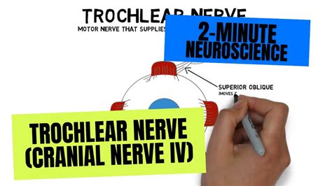 Trochlear Nerve Palsy Eye Position