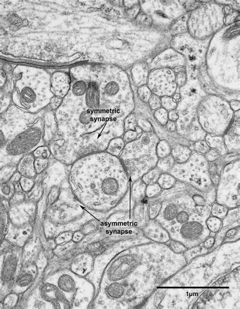 Chapter 9 – synapses » Fine Structure of the Aging Brain | Boston University