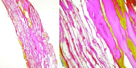 Histological view of filum terminale staining with Verhoeff ×10, seen... | Download Scientific ...