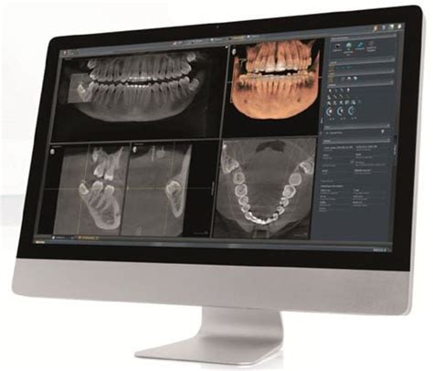 Dental CT Scan Explained | Seapoint Clinic | Dental Clinic