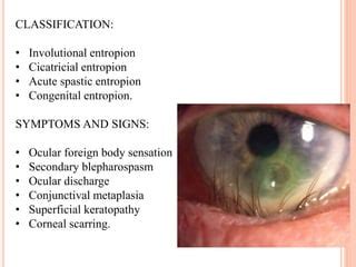 Entropion | PPT
