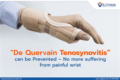 De Quervain S Tenosynovitis Treatment Top Non Surgica - vrogue.co