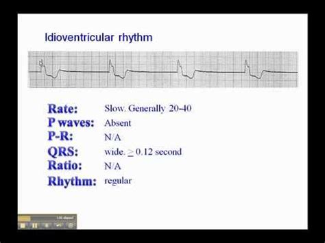 Pinterest | Medical coding, Cardiovascular system, Nurse