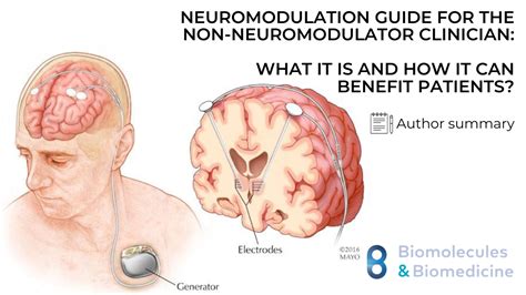 Neuromodulation guide for the non-neuromodulator clinician: What it is ...