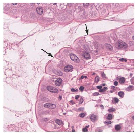 Histology, Goblet Cells - StatPearls - NCBI Bookshelf