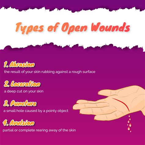 Types of Open Wounds #WoundsCare #HealthCareServices #AdvantHomeHealthCareServicesInc | Health ...