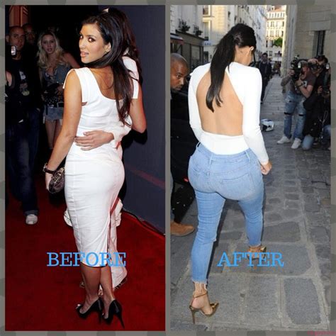 Kim Kardashian Plastic Surgery Photos [Before & After] - Surgery4