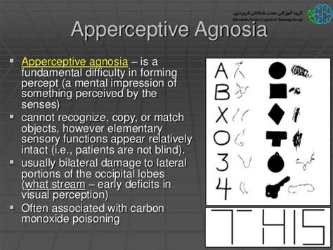 apperceptive vs associative agnosia - Captions Rotation