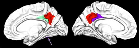 Regions of interest in the posterior cingulate cortex (dorsal bank of ...