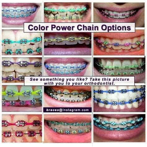 Braces: Navy Blue Braces Color