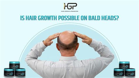 Is Hair Growth Possible on Bald Heads?