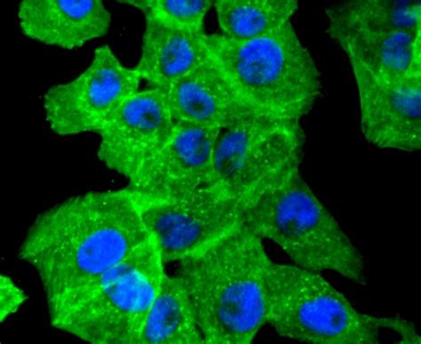 ACTA2 Recombinant Antibody – Bioss