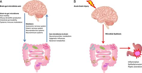 A Reappraisal of the Pathophysiology of Cushing Ulcer: A Nar ...