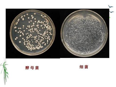 真菌的形态结构与繁殖体_菌丝_孢子_细胞