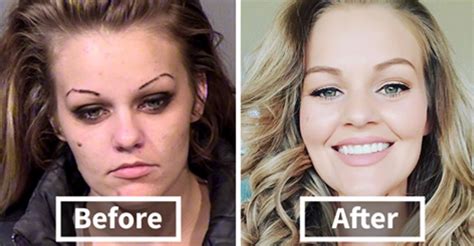 Stunning Before and After Transformations of People Who Quit Drugs | artFido