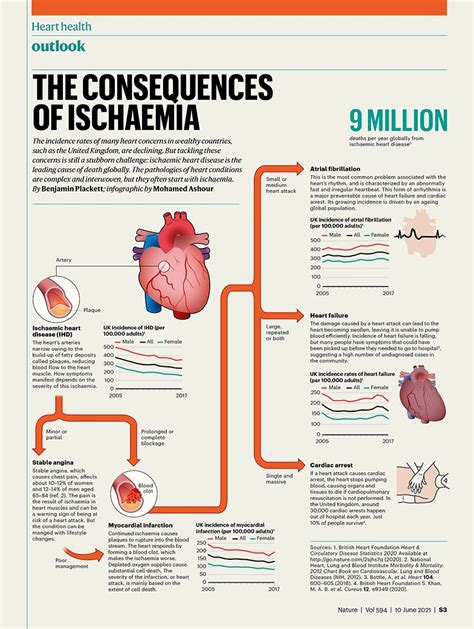 A graphical guide to ischaemic heart disease