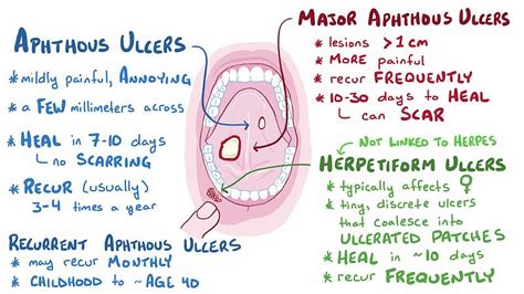 aphthous ulcer,what to do?