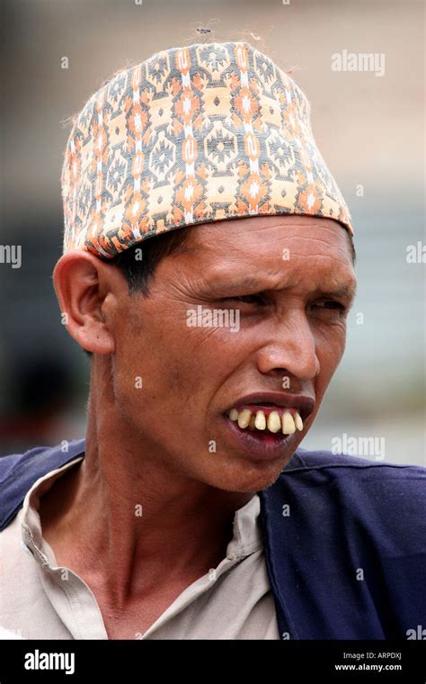 "Man with huge teeth Kathmandu Stock Photo - Alamy