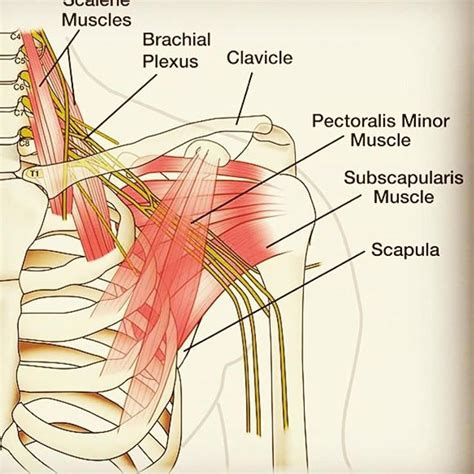 Images Of Anatomy Brachial Plexus Drawing | The Best Porn Website