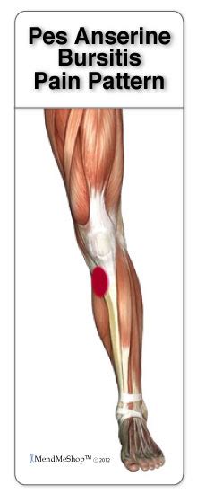 Pes Anserine Bursitis