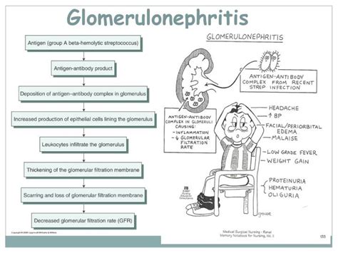 PPT - Introduction to nephrology Acute and chronic glomerulonephritis PowerPoint Presentation ...